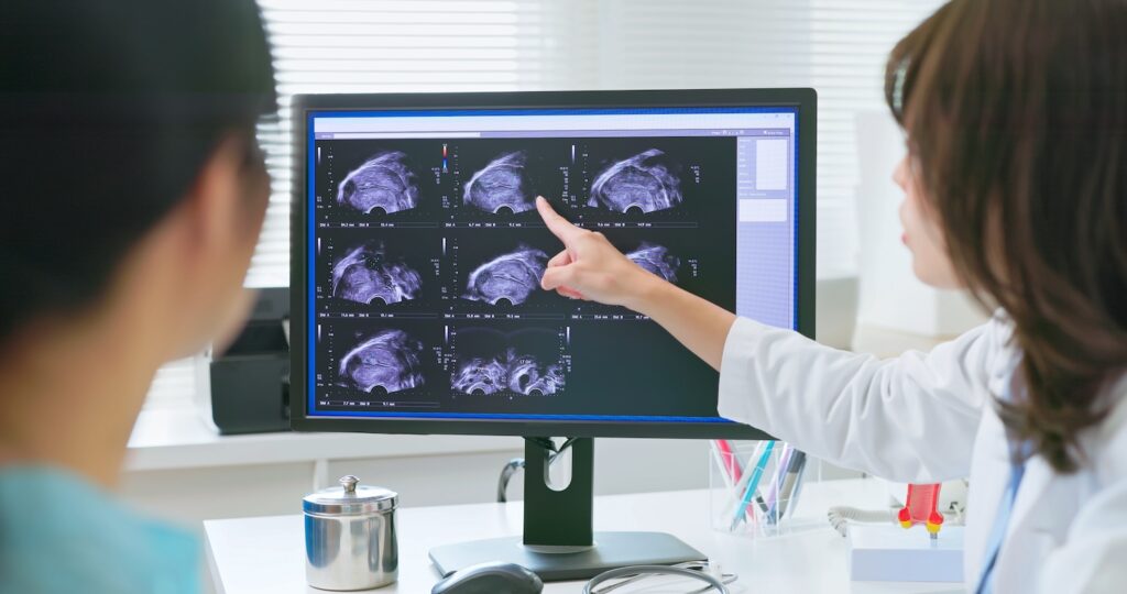 Ultrasound News featuring the latest medical imaging updates